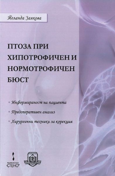 Птоза при хипотрофичен и нормотрофичен бюст