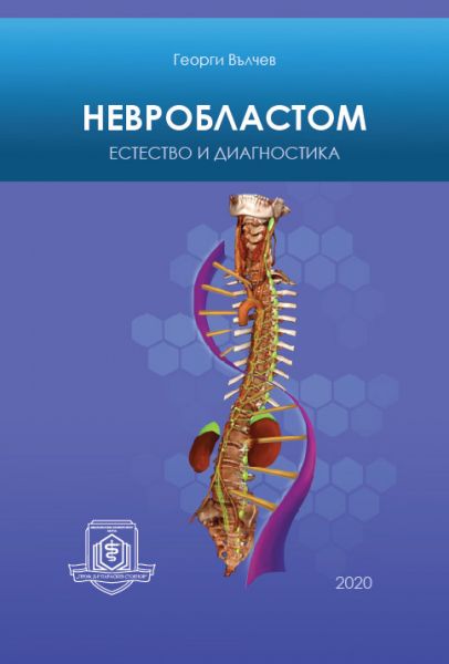 Невробластом. Естество и диагностика